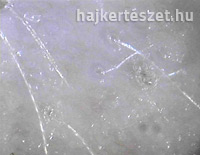 új hajszálak növekedése
