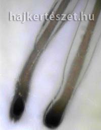 zsírosodott haj